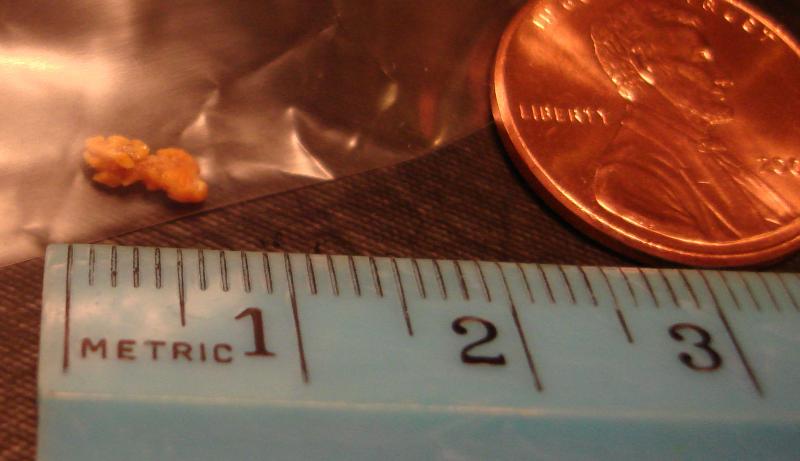 My 6mm Kidney Stone Off Topic Public Joe S Ultimate Off Topic